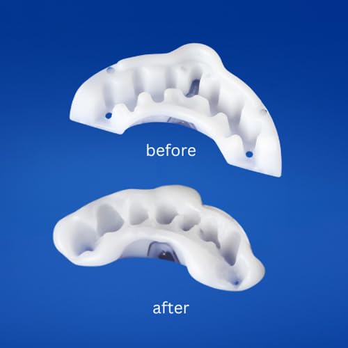 [Australia] - – FDA-Cleared Mouthguard for Nighttime Teeth Grinding and Clenching, Custom-Fit Night Guard, Dentist-Invented, Easily Refit for Comfort, 3-Year Warranty 