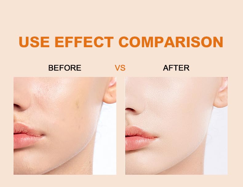 Vitamin C Brightening Facial Serum – Fade Dark Spots, Even Skin Tone & Reduce Wrinkles for Radiant, Youthful Glow (30ml)