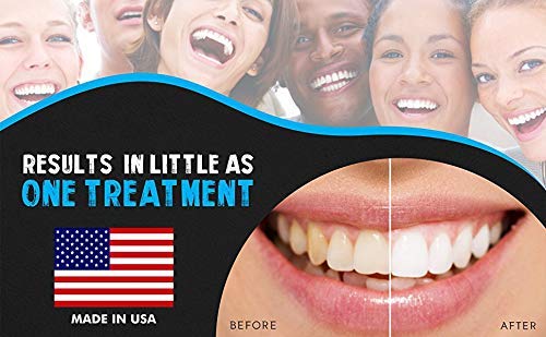 Bright White Smiles Teeth Whitening Kit, 35% Carbamide Peroxide Gel for Professional Results at Home, Whiter Refill System Includes 5X 5cc/ml Syringes