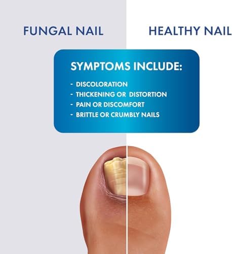 Laser Spray Antifungal Treatment, 3 oz, A Touch-Free Design To Help Prevent Fungal Infections | Hands-free spray nozzle delivers Tolnaftate 1% antifungal protection without touching affected areas