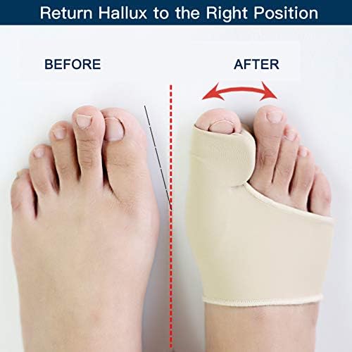 [Australia] - Bunion corrector, bunion splint, 1 pair, support, with integrated silicone gel padding, for pain relief from hallux valgus 
