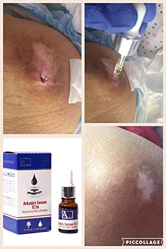 Natura Resort AMAZON Arkada TC16 Serum