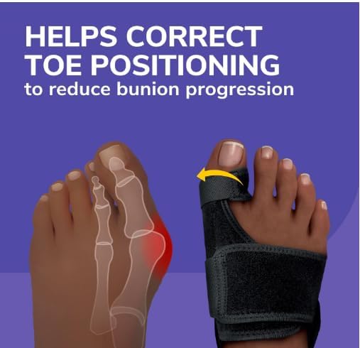 ALINO Bunion Corrector | Adjustable Toe Straightener for Men & Women | Toe Corrector Universal Fit for Left & Right Foot | Leg Finger Straightener