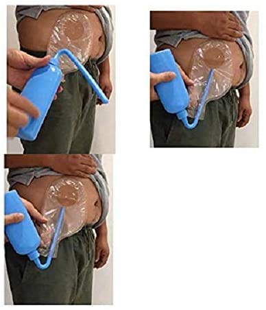[Australia] - Colostomy Bag Cleaning Tool,Stoma Bags Plastic Cleaning Bottle for All Ostomy Bags for Permanent Use (3PCS PZ) 3 Count (Pack of 1) 