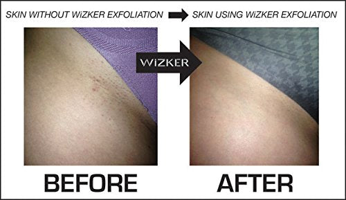 [Australia] - WIZKER® Premium Ingrown Hair Exfoliating Brush: Soft + Firm Face Body Scrubber, Sensitive Skin Exfoliator, Prevents Razor Bumps, Shave, Laser, Wax, Epilation, Dermaplaning – Waterproof, Mold Resistant Sea Blue 