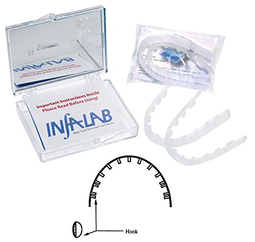 [Australia] - Orthodontic Braces Lip Guard Protector Shield (1 Set - Upper - Lower Teeth) with Instructions by AdentalZ 