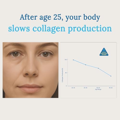 Pro Hydrolyzed Marine Collagen Powder 286g – Pure Marine Collagen Powder with Vitamin C & Hyaluronic Acid – 100% Pure- for Skin, Joints,Hair,Bones & Muscles Support (28 Sachets) 28 Sachets（1 Month Supply）