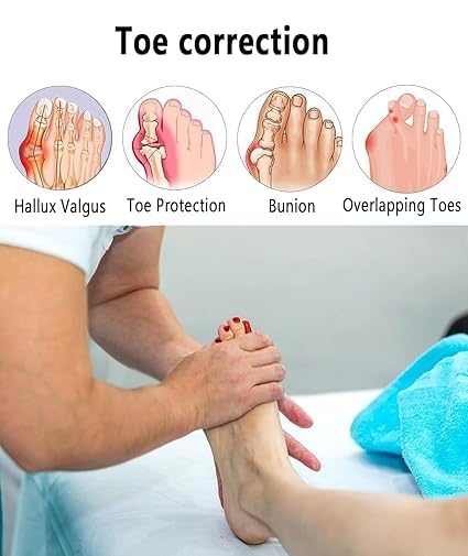 ALINO Bunion Corrector | Adjustable Toe Straightener for Men & Women | Toe Corrector Universal Fit for Left & Right Foot | Leg Finger Straightener