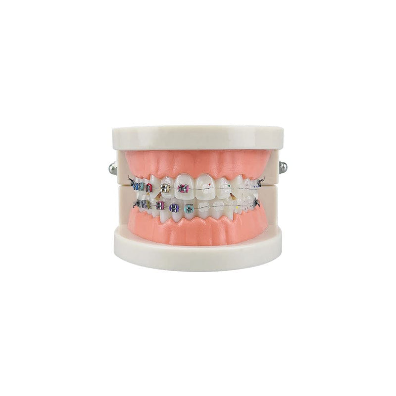 Standard Orthodontic Teeth Model, YOUYA DENTAL Demonstration Orthodontic Model Teeth Teach Study Tools with Metal and Ceramic Bracket(Red) Orthodontic Model - 1/2Metal and 1/2Ceramic