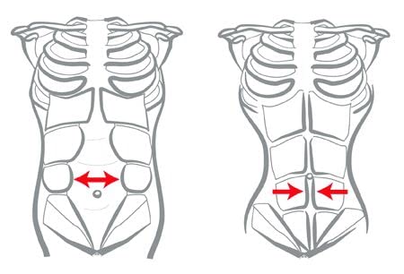 RADE Abdominal Binder, Waist And Stomach Wrap, Hernia And Abdominal Surgery Support, C Section Postpartum Recovery, Core Stabilizer Anti Sciatic Belly Bant For Women And Men (Black, Small) Black