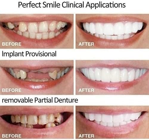 [Australia] - ‌2 Pairs Natural-Looking Temporary Smile Solutions, Top & Bottom Adjustable for Comfortable Experience(Red) Red 1 Fl Oz (Pack of 1) 