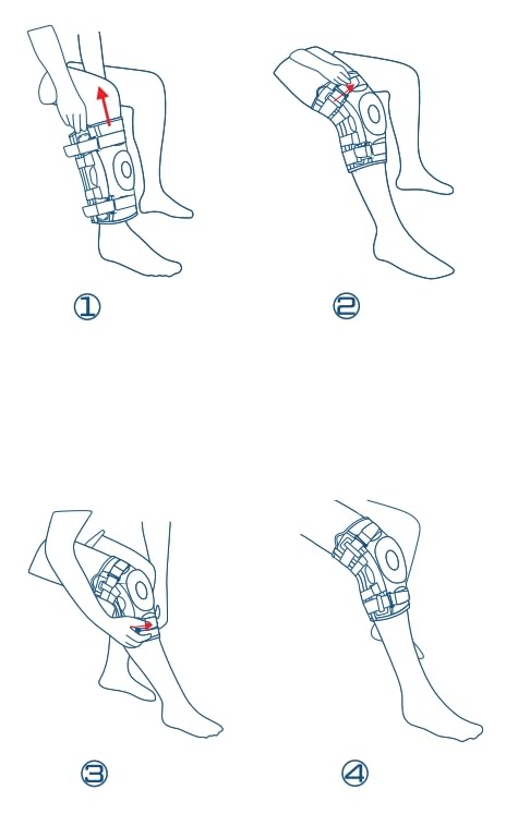 [Australia] - NEENCA Professional Knee Brace for Knee Pain, Hinged Knee Support with Patented X-Straps Fiting System, Strong Stability for Joint Pain Relief, Arthritis, Meniscus Tear, ACL, PCL, MCL, Sports, Workout Medium Black-Single 