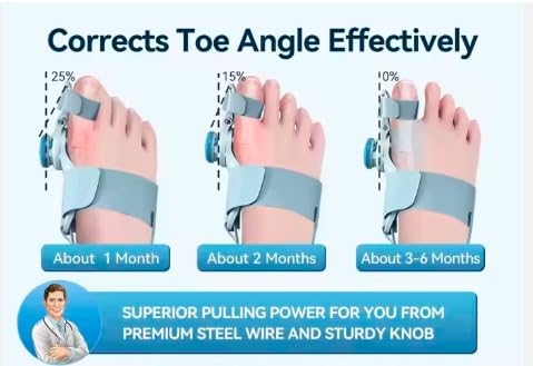 ALINO Bunion Corrector | Adjustable Toe Straightener for Men & Women | Toe Corrector with Rotating Knob, Universal Fit for Left & Right Foot | Leg Finger Straightener | Free Toe Exerciser