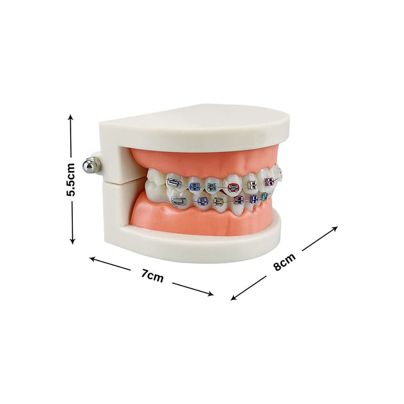 Standard Orthodontic Teeth Model, YOUYA DENTAL Demonstration Orthodontic Model Teeth Teach Study Tools with Metal and Ceramic Bracket(Red) Orthodontic Model - 1/2Metal and 1/2Ceramic