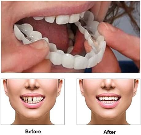2 Pairs, Nature and Comfortable Regain Confidence Smile,Temporarily Adjustable for Men and Women.(White) White