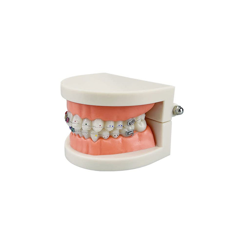 Standard Orthodontic Teeth Model, YOUYA DENTAL Demonstration Orthodontic Model Teeth Teach Study Tools with Metal and Ceramic Bracket(Red) Orthodontic Model - 1/2Metal and 1/2Ceramic