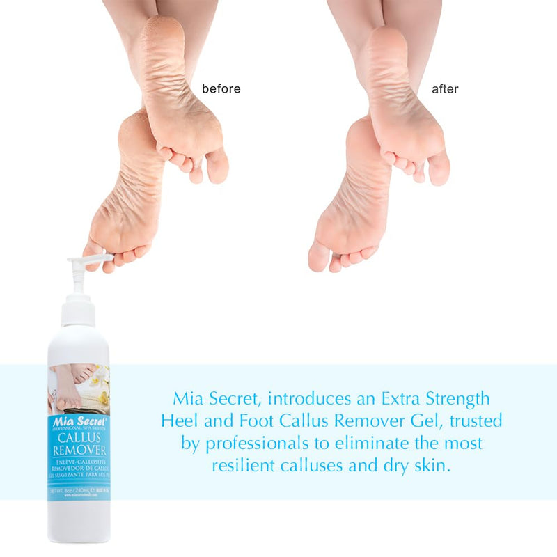 [Australia] - Mia Secret Professional Callus Remover Gel (8oz) - Salon-Grade Pedicure Experience, Extra Strength Formula for Soft, Smooth Feet - Revitalize Cracked and Dry Skin 1 Count (Pack of 1) 