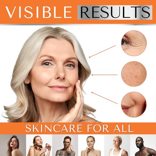 BRIGHTENING VITAMIN C SERUM with Niacinamide, Beta Glucan & Hyaluronic Acid - Anti Aging & Hydrating Vitamin Illuminating Serum & Dark Spot Corrector - Hidratante Facial for Men & Women by DERMAWORKS