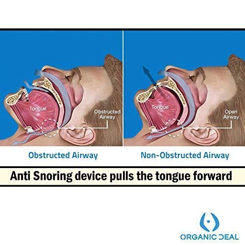 [Australia] - Organic Deal Anti Snoring Device - Anti Snoring Tongue Holder Prevent Snoring - Snoring Stopper - Best Help Against Snoring - Better results than snoring stopper clips or spray 