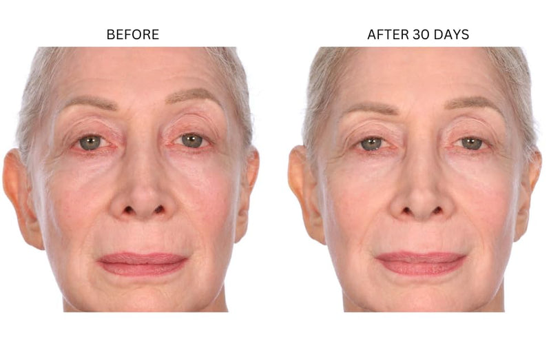 Consult Beaute XTERNA-Q CoQ10 Anti-Aging Daily Moisture Cream for Face 1 Oz