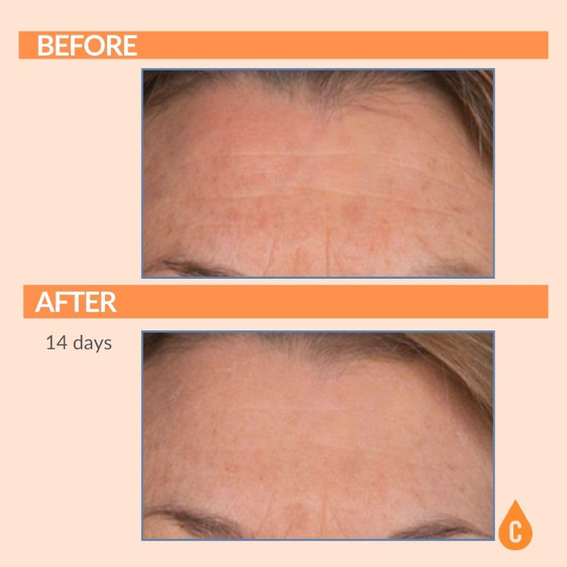 Serious Skincare Vitamin C Serum for Face, Anti-Aging, for Dark Spots 1 Oz