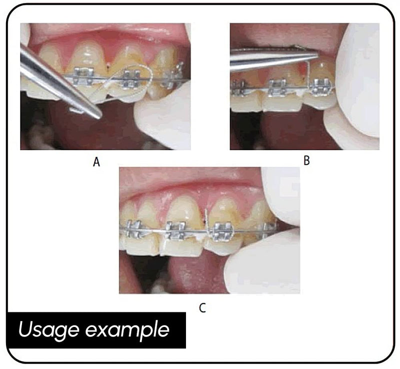 [Australia] - Braces Wire Orthodontic Dental Ligature Wire for Braces for Home Use Stainless Steel 40g 0.25mm 