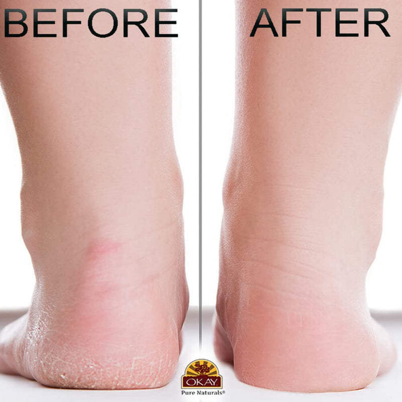 OKAY Peppermint Foot Scrub - Exfoliating Foot Scrub, Foot Exfoliator, Great for Cracked Heels, Pedicures, Dead Skin Remover, Exfoliant for Calluses, Moisturizer for Dry Skin - 6 Oz (Pack of 1) 6 Ounce (Pack of 1)