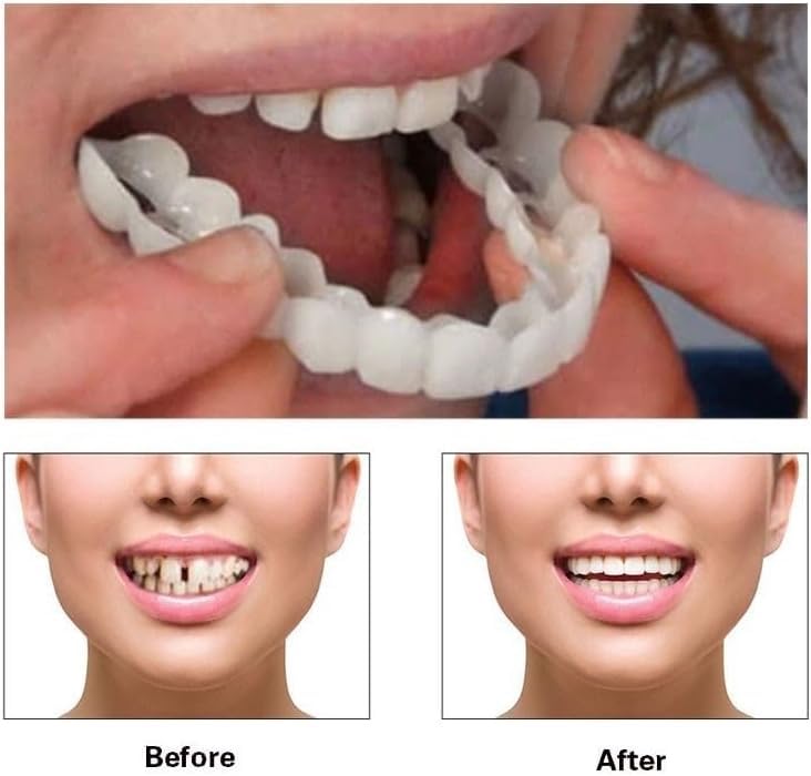 [Australia] - ‌2 Pairs Natural-Looking Temporary Smile Solutions, Top & Bottom Adjustable for Comfortable Experience(Red) Red 1 Fl Oz (Pack of 1) 