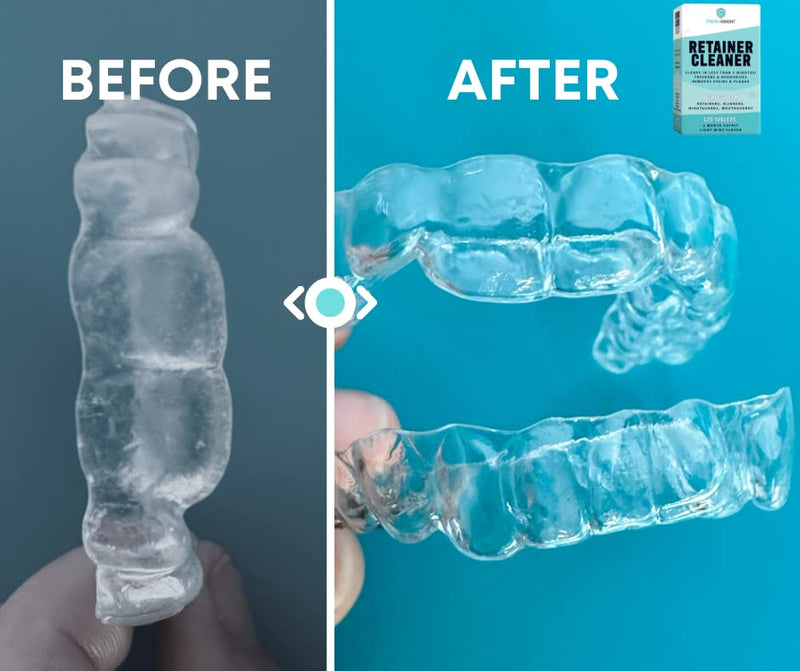 [Australia] - Retainer Cleaner Tablets 120 - Invisalign Cleaner - Denture Cleaner. Efferdent Retainer Cleaner Tablets, Night Guard, Mouth Guards, Aligners & Dental Appliance Cleaner - 4 Month Supply. 