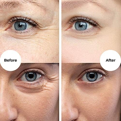 Gle for Wrinkles, Fine Lines and Aging Spots Anti-Aging Skincare Moisturizer with Vitamin E, Algae Extract and Vitamins B3 and B5 4 Fl Oz (Pack of 1)