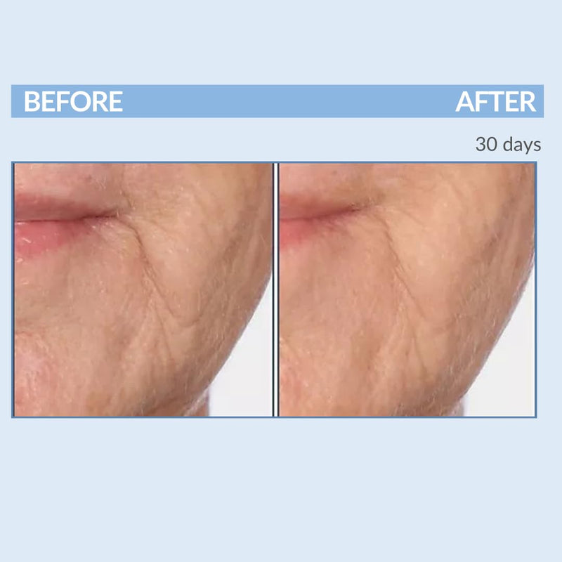 Serious Skincare Vitamin A Cream Retinol Moisturizer For Face 2 Oz (2Pack)