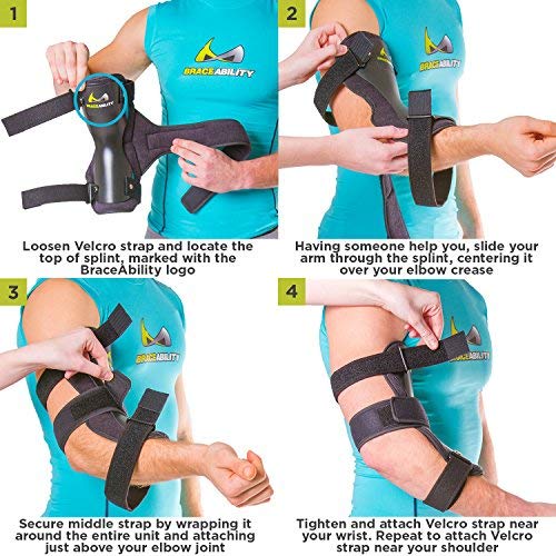 BraceAbility Cubital Tunnel Syndrome Elbow Brace | Splint to Treat Pain from Ulnar Nerve Entrapment, Hyperextended Elbow Prevention and Post Surgery Arm Immobilizer - L (LARGE/X-LARGE)