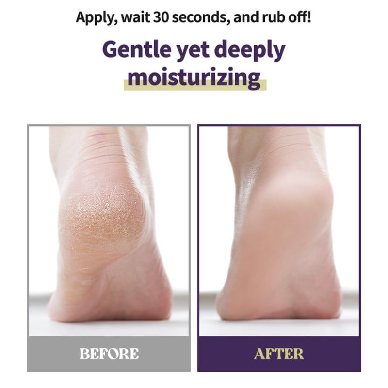 [Australia] - Foot Callus Remover Home Care Set ‚Äì Professional Stainless Foot File & Scrubber, Exfoliating Serum for Smooth Skin, Effective on Wet and Dry Feet 