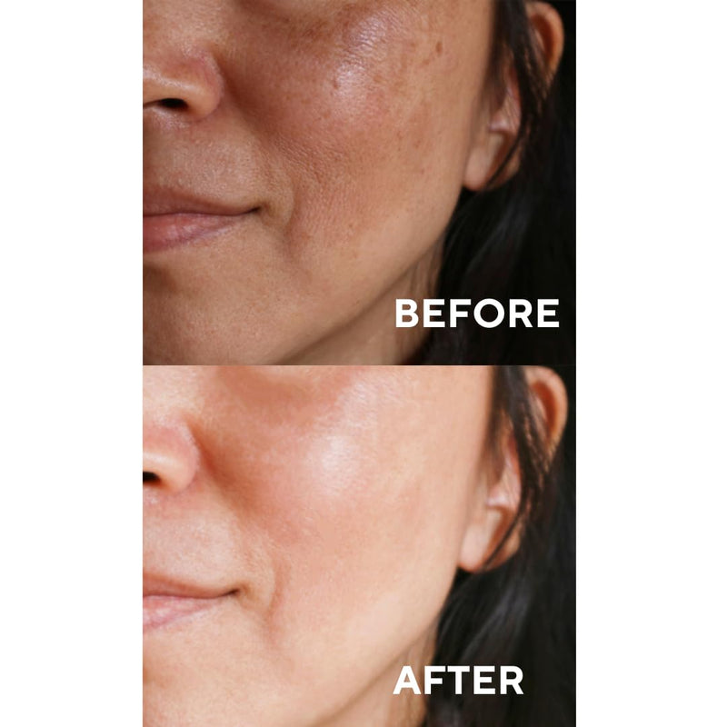 The Ceel 20% Vitamin C Brightening Anti-Aging Serum for Face with Ascorbic, Ferulic Acid & Vitamin B5 - Paraben & Perfume Free Skin Care Formula for Hydration, Wrinkles, Dark Spots, & Radiance - 30ml