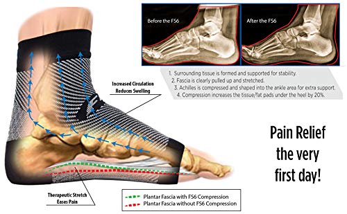 OrthoSleeve FS6 Compression Foot Sleeves for Women & Men, Helps Plantar Fasciitis Relief, Heel Pain, Achilles Tendonitis Support & Swelling (1 Pair) Small Natural