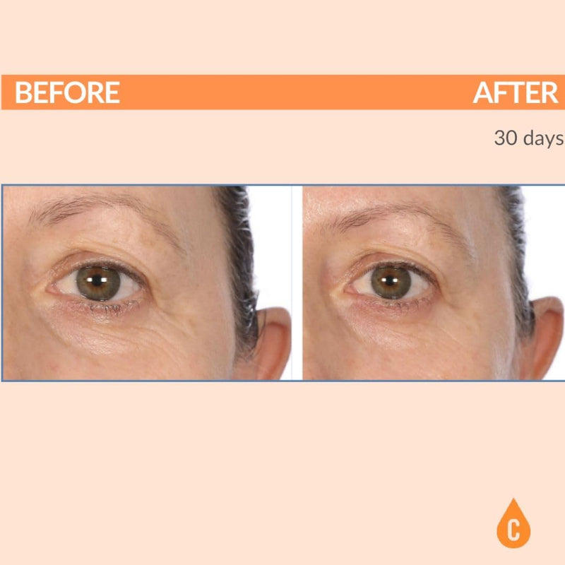 Serious Skincare Vitamin C Brightening Under Eye Gel Serum Treatment 0.5 oz | Hyaluronic Acid, Collagen, Fine Lines, Crow's Feet, Wrinkles, Dark Circles, Hydrating, Soothing, C3 Plasma C Ester