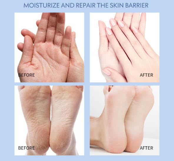 [Australia] - Lexenic Anti-Crack Foot Cream - 2pcs Foot Care Cream for Dry Cracked Heels and Feet, Moisturizing | Softening | Nourishing, Remove Dead Skin And Softening Dry Skin 2pcs set 