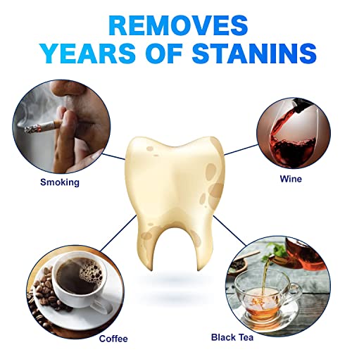 [Australia] - Sensitive Teeth Whitening Strips Kit: Professional Dental Whitening Set - 14 Hydrogen Peroxide-Free Treatments for Whiter Teeth - Effective & Gentle Teeth Whitener (28 PCS) 