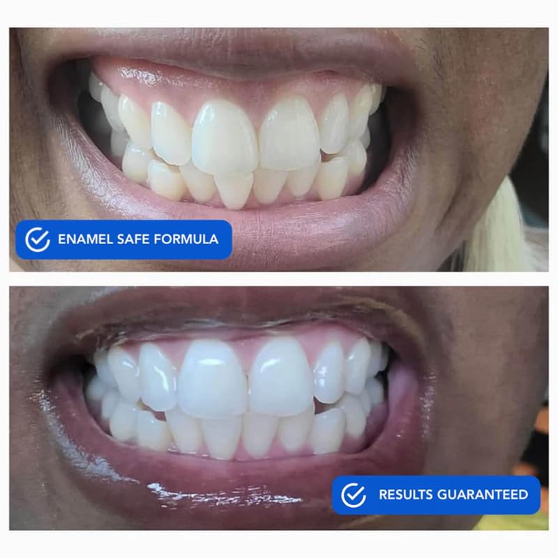 [Australia] - SNOW Diamond Dissolving Teeth Whitening Strips - Gentle & Enamel Safe White Strips for Teeth Whitening, at-Home Dental Hygiene & Tooth Care with Hydroxyapatite - 42 Ct 42 Count (Pack of 1) 