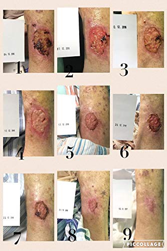 Natura Resort AMAZON Arkada TC16 Serum