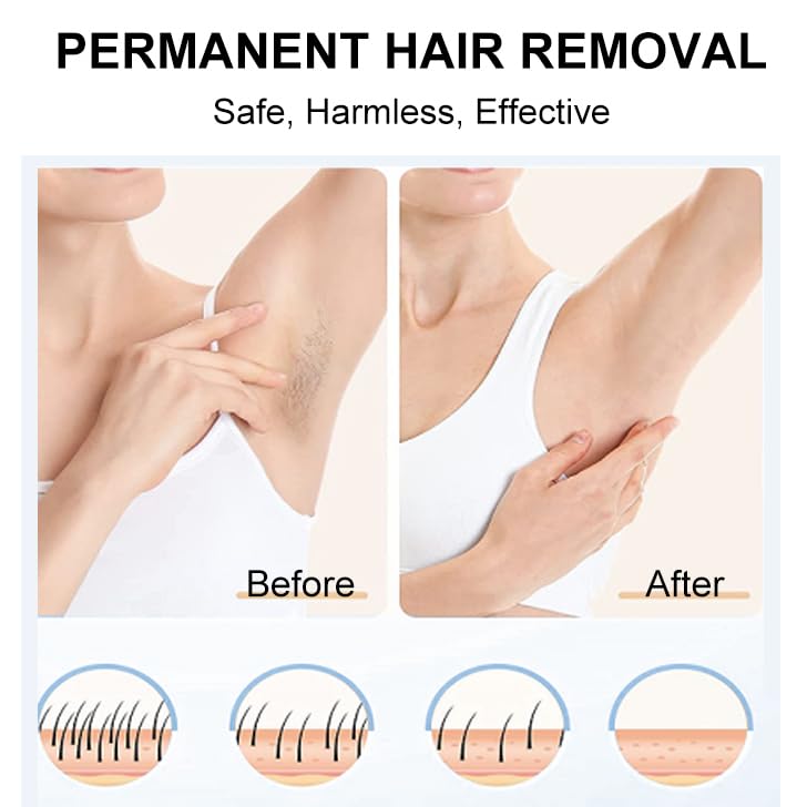 [Australia] - IPL Hair Removal,Laser Hair Removal device with Ice Cooling, Painless & Long-Lasting Results, At-Home Hair Remover, 5 Levels, 2 Modes, 3 in 1 Set, Permanent hair removal for women and man. 