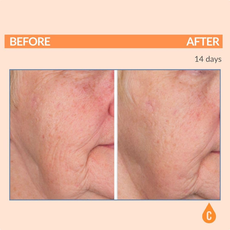 Serious Skincare Vitamin C Serum for Face, Anti-Aging, for Dark Spots 1 Oz