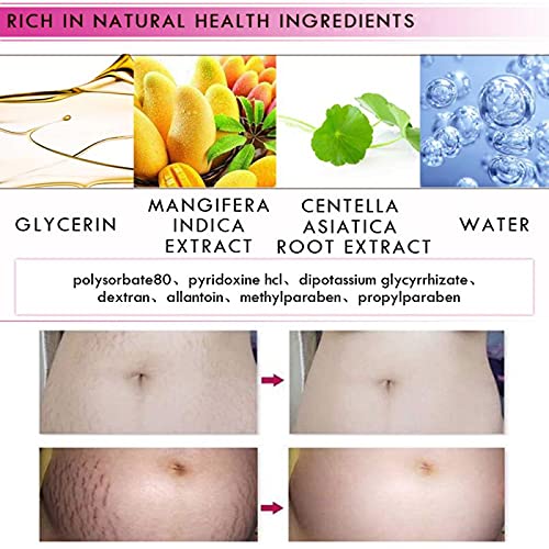 [Australia] - Mango Stretch Marks and Scar Cream, Stretch Marks and Scar Removal Cream for Pregnancy, Stretch Marks Scar Belly Creams for Wrinkles, Obesity Fat Stretch Mark Moisturizing, Remove Marks (40g) 