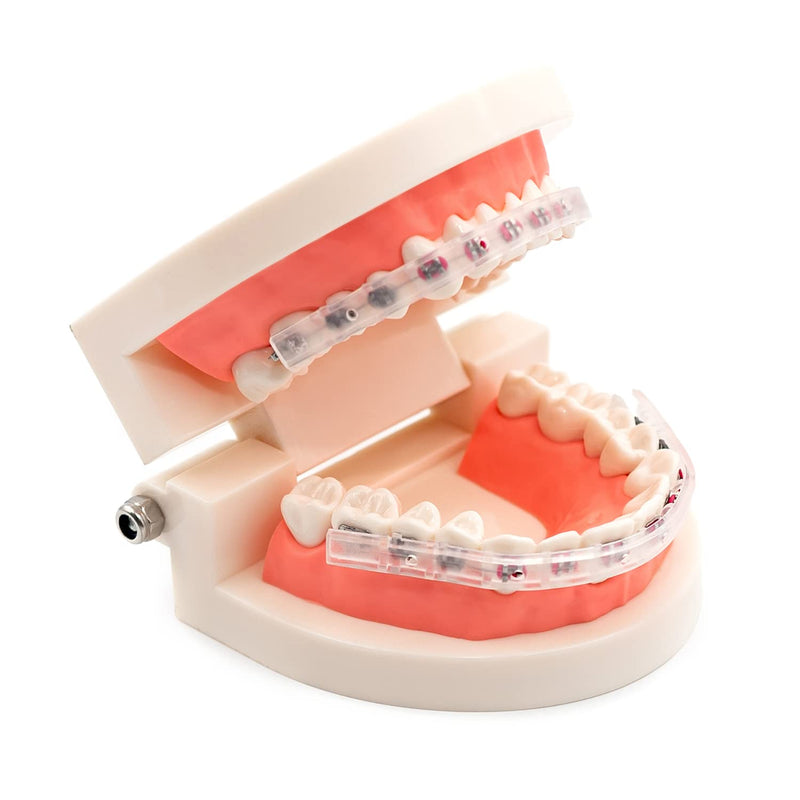 [Australia] - AIM Clear Lip Protector for Braces with Carry Case – Comfort Covers, Wax Alternative, Trim-to-Fit Teeth Shield (Upper + Lower) 