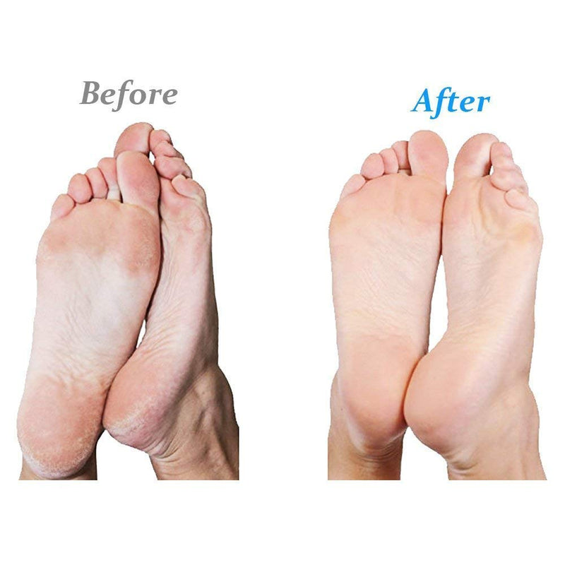 [Australia] - Emjoi Micro-Pedi Ultra Callus Remover (Pink) 