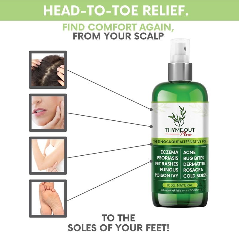 [Australia] - Plus Eczema Treatment, Psoriasis Treatment Treats Acne, Dermatitis, Rosacea, Cold Sores, Pet Rashes, Bug Bites, Poison Ivy, Anti Itch Spray for Itchy Skin Relief for Kids, Adult & Baby 8 Fl Oz (Pack of 1) 