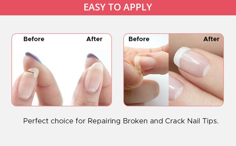 Professional Nail Repair Kit for Broken Cracked Split and Weak Nails. Easy to Use and Apply. Life saver nail Kit for Quick Fix Solution.