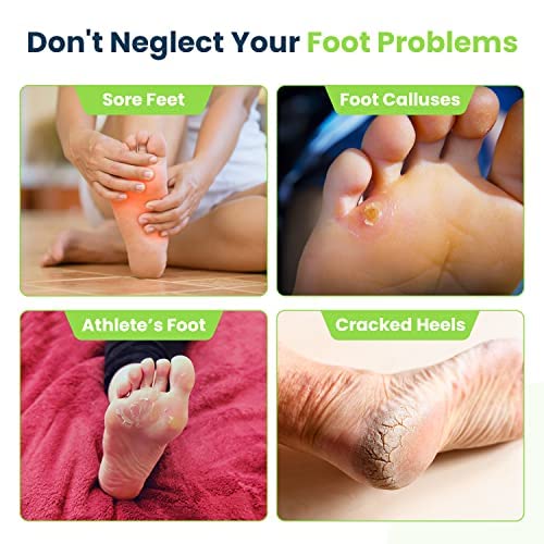 [Australia] - Tea Tree Foot Soak & Callus Remover Gel Kit - Extra Strength Callus Remover Gel & Foot Soak With Epsom Salts For Calluses & Tea Tree Oil Foot Cream - Moisturizing Athletes Foot Care For Dry Feet 