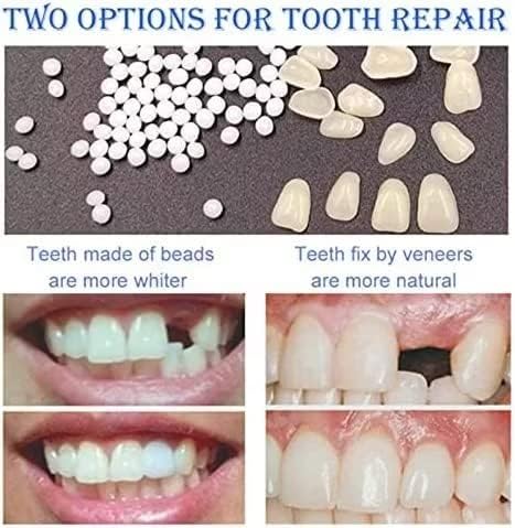 [Australia] - Fake Tooth Repair Kit-Thermal Beads for Filling Fix The Missing and Broken Tooth or Adhesive The Denture Fake Teeth 
