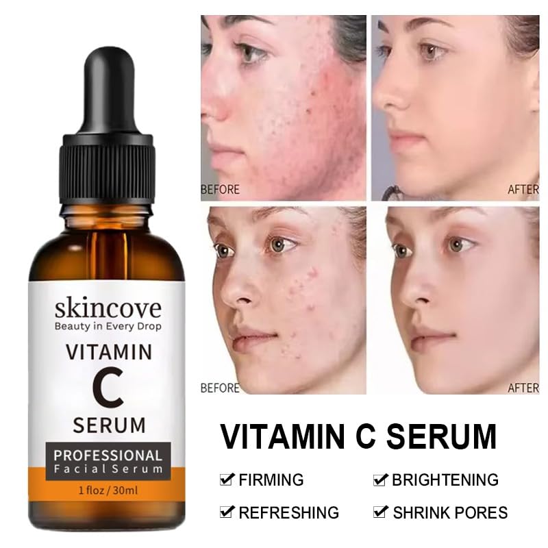 Skincove Vitamin C Serum Anti Aging Facial Serum with Vitamin C, Hyaluronic Acid, Vitamin E Brightening Serum Even Skin Tone, Improve Appearance of Dark Spots, Fine Lines & Wrinkles, 1 Fl Oz